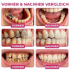 Zahnfleisch-Gel, 10 ml