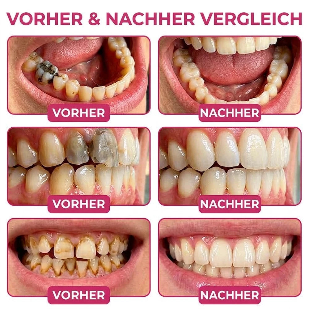 Zahnfleisch-Gel, 10 ml