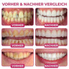 Zahnfleisch-Gel, 10 ml