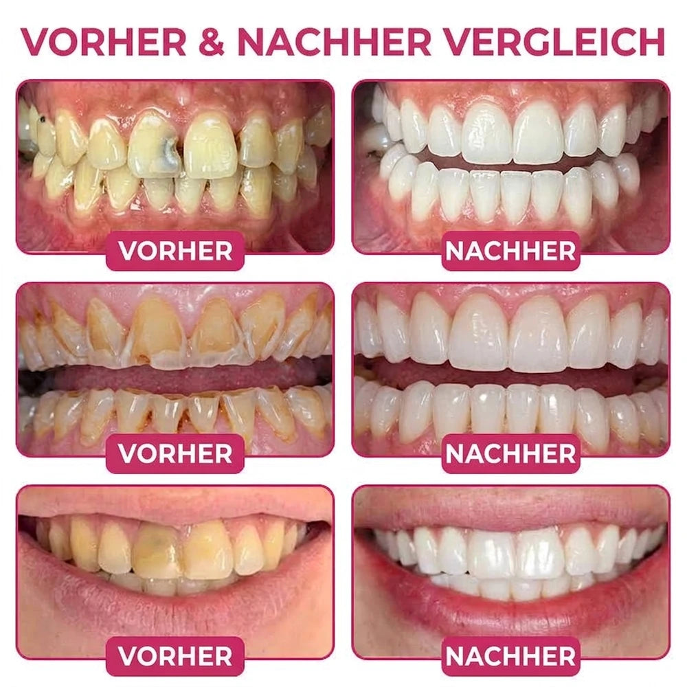 Zahnfleisch-Gel, 10 ml